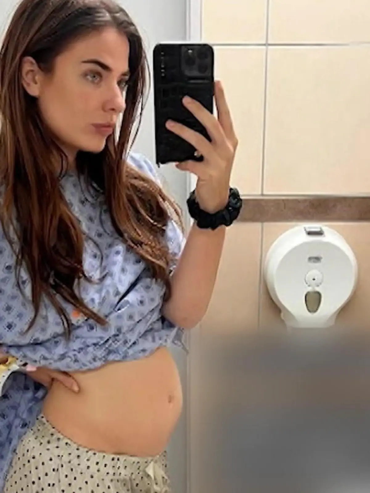 Bild zu: "Alle dachten, Tamsyn wäre im 5. Monat schwanger! „Ich wusste, dass es kein Baby ist“"