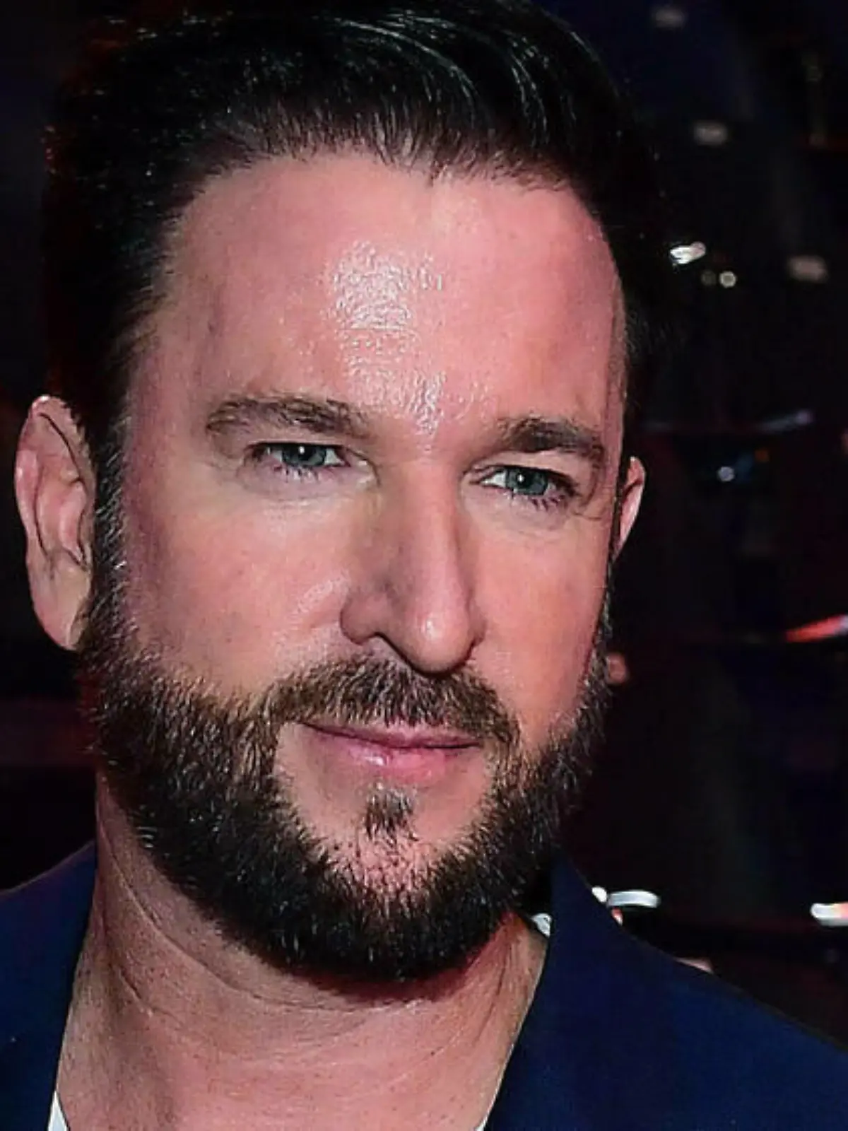Michael Wendler: Deshalb hatte er eine Nasen-OP