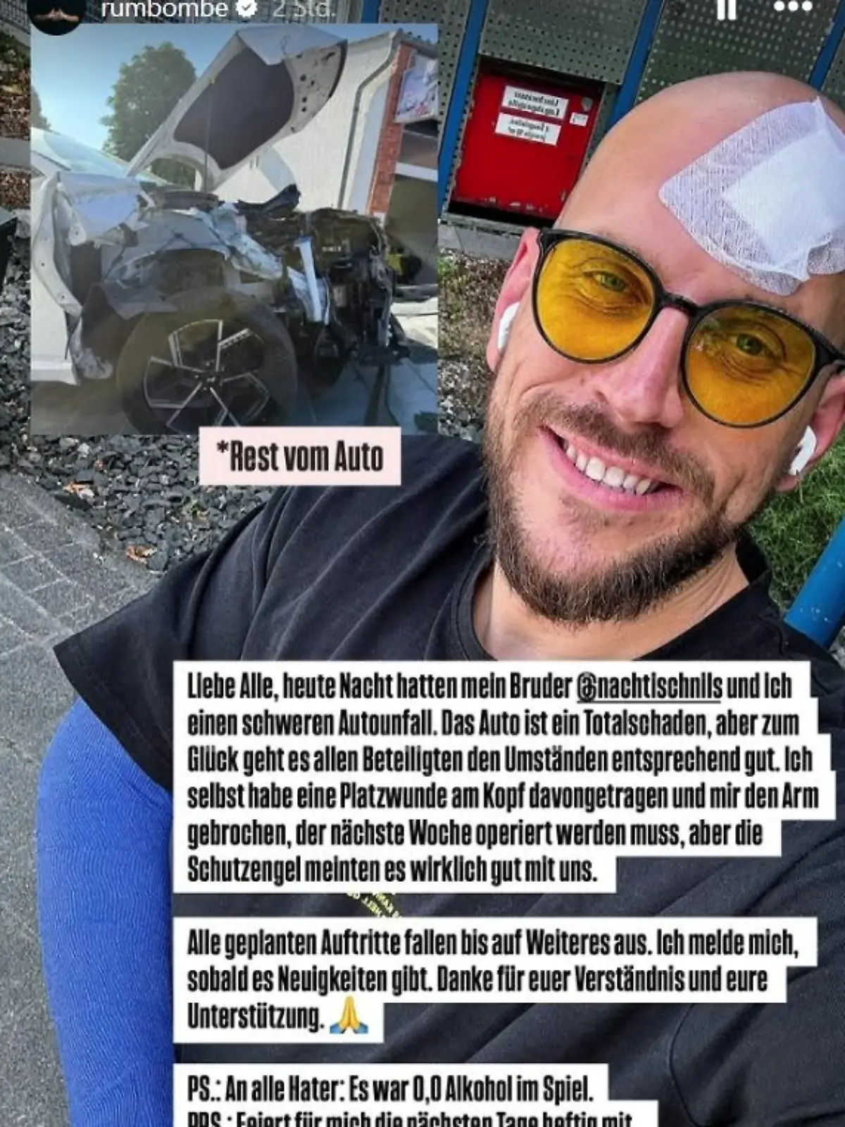 Rumbombe hat sich beim Autounfall unter anderem ein Arm gebrochen. 