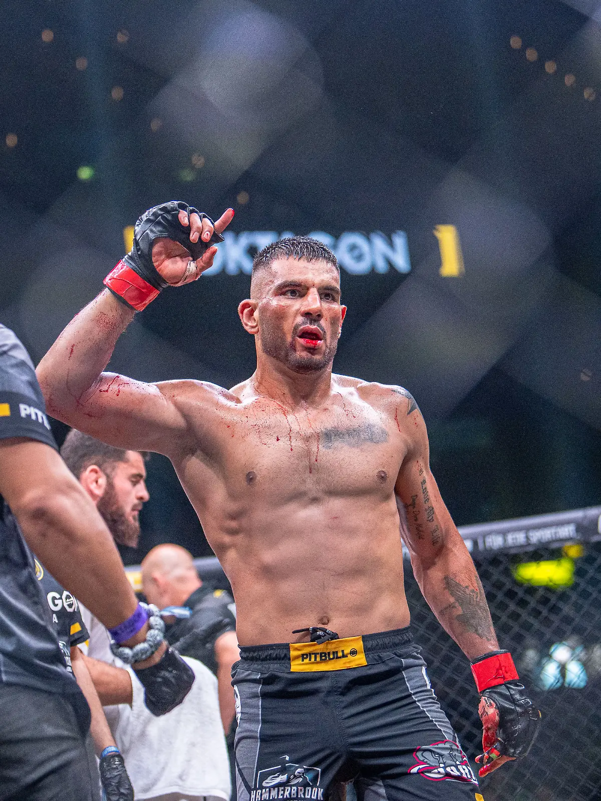 Bild zu: "MMA-Star siegt mit gebrochenem Kiefer!"