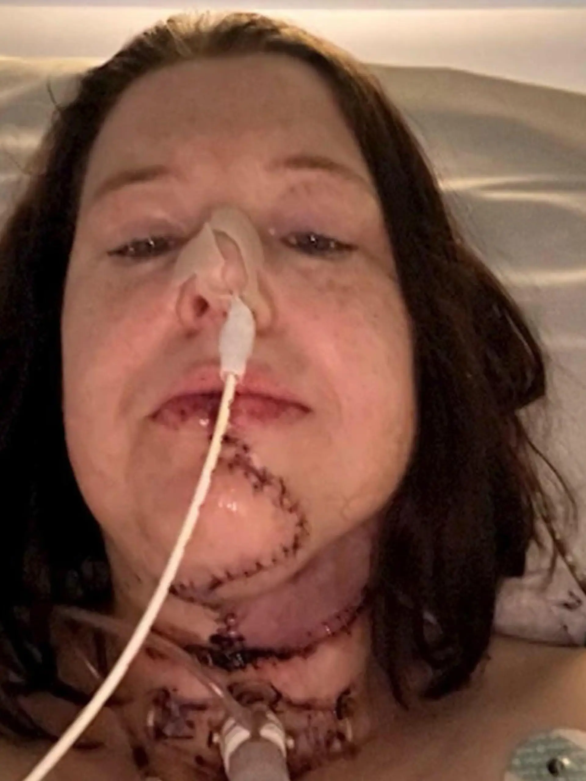 Bild zu: "Kleiner Abszess unterschätzt – doch damit starten Emmas (45) tödliche Schicksalsschläge"