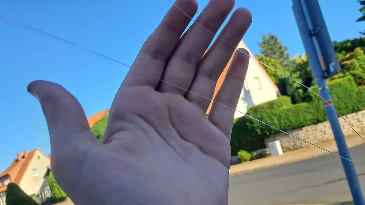 Diese Angelschnur soll den Jungen (10) verletzt haben.