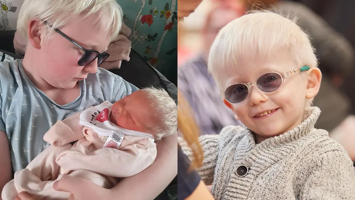SONDERKONDITIONEN: SATZPREIS! Couple ?blessed? to have three children with albinism bemoan ?rude? comments and say ?never judge a book by its cover?
A mother of five who has three children born with albinism, which gives them pale skin and visual impairments which can cause them to ?walk into buildings?, has said she wishes people would stop making ?rude? and ?nasty? comments as she and her husband feel ?so blessed to have them?.
Stacey Chappell, 34, a full-time mother, and her husband Jason, 40, a cleaner, from Hebburn, South Tyneside, ?did not know anything about? albinism ? a condition which affects the production of melanin, the pigment that colours the skin, hair and eyes ? prior to their children?s diagnoses.
Albinism affects the family?s everyday life as the three children have to wear factor 50 sun cream every time they go outside, even when it is cloudy, and the couple have installed blackout curtains at home as sunlight can cause severe burns due to the reduced amount of melanin in their skin.
After the birth of their first child Jay, 15, Stacey said she ?blamed (herself)? for his albinism because ?(she) made him? and the couple were in and out of hospital ?all the time?.
Stacey said she suffered with postnatal depression and initially rejected help from others as she felt it was ?(her) responsibility? to look after him; however, the couple later made contact with Guide Dogs ? the leading UK charity for people with sight loss ? and this has been invaluable.
Despite the daily challenges the couple face, they said they feel ?privileged? to have three children with a ?rare? condition and they hope that by talking more openly about albinism, people will think twice before making ?nasty? comments, as people should ?never ever judge a book by its cover?.
?I feel privileged. I?m so blessed to have them because it?s a rare condition,? Stacey said.
?We?re actually honoured to have them as our kids; they?re so rare.
?People will go, ?Look at his hair, look at his eyelashes?? and I?ll say, ?Yeah, he?s an albino?.
?Then they?ll say, ?Why do you feel like you?ve got to tell people??, and I?ll say, ?Do you know why? Because I?m so privileged; I feel so special having them as my kids?.?
Three of Stacey and Jason?s children ? Jay, 15, Leon-James, three, and Amelia-Grace, one ? were born with albinism and, as a result, all three wear glasses and have visual impairments.
The couple?s other two children ? Sky, 13, and Lexi, 11 ? do not have the condition.


