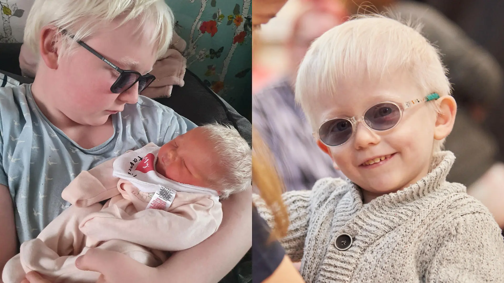 SONDERKONDITIONEN: SATZPREIS! Couple ?blessed? to have three children with albinism bemoan ?rude? comments and say ?never judge a book by its cover?
A mother of five who has three children born with albinism, which gives them pale skin and visual impairments which can cause them to ?walk into buildings?, has said she wishes people would stop making ?rude? and ?nasty? comments as she and her husband feel ?so blessed to have them?.
Stacey Chappell, 34, a full-time mother, and her husband Jason, 40, a cleaner, from Hebburn, South Tyneside, ?did not know anything about? albinism ? a condition which affects the production of melanin, the pigment that colours the skin, hair and eyes ? prior to their children?s diagnoses.
Albinism affects the family?s everyday life as the three children have to wear factor 50 sun cream every time they go outside, even when it is cloudy, and the couple have installed blackout curtains at home as sunlight can cause severe burns due to the reduced amount of melanin in their skin.
After the birth of their first child Jay, 15, Stacey said she ?blamed (herself)? for his albinism because ?(she) made him? and the couple were in and out of hospital ?all the time?.
Stacey said she suffered with postnatal depression and initially rejected help from others as she felt it was ?(her) responsibility? to look after him; however, the couple later made contact with Guide Dogs ? the leading UK charity for people with sight loss ? and this has been invaluable.
Despite the daily challenges the couple face, they said they feel ?privileged? to have three children with a ?rare? condition and they hope that by talking more openly about albinism, people will think twice before making ?nasty? comments, as people should ?never ever judge a book by its cover?.
?I feel privileged. I?m so blessed to have them because it?s a rare condition,? Stacey said.
?We?re actually honoured to have them as our kids; they?re so rare.
?People will go, ?Look at his hair, look at his eyelashes?? and I?ll say, ?Yeah, he?s an albino?.
?Then they?ll say, ?Why do you feel like you?ve got to tell people??, and I?ll say, ?Do you know why? Because I?m so privileged; I feel so special having them as my kids?.?
Three of Stacey and Jason?s children ? Jay, 15, Leon-James, three, and Amelia-Grace, one ? were born with albinism and, as a result, all three wear glasses and have visual impairments.
The couple?s other two children ? Sky, 13, and Lexi, 11 ? do not have the condition.