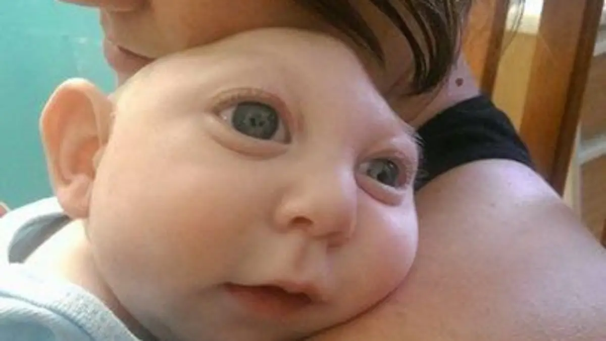 Baby Jaxon Gehirn Missbildung 1.jpg