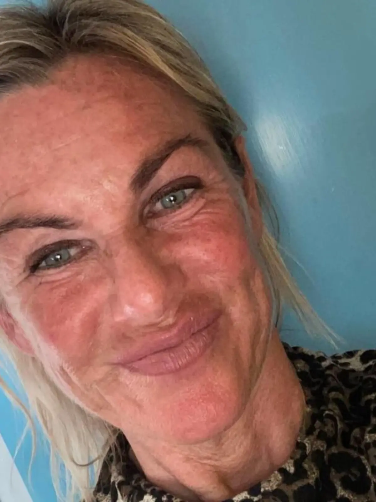 Berit Linnet im Krankenhaus wegen Lakritz-Tee