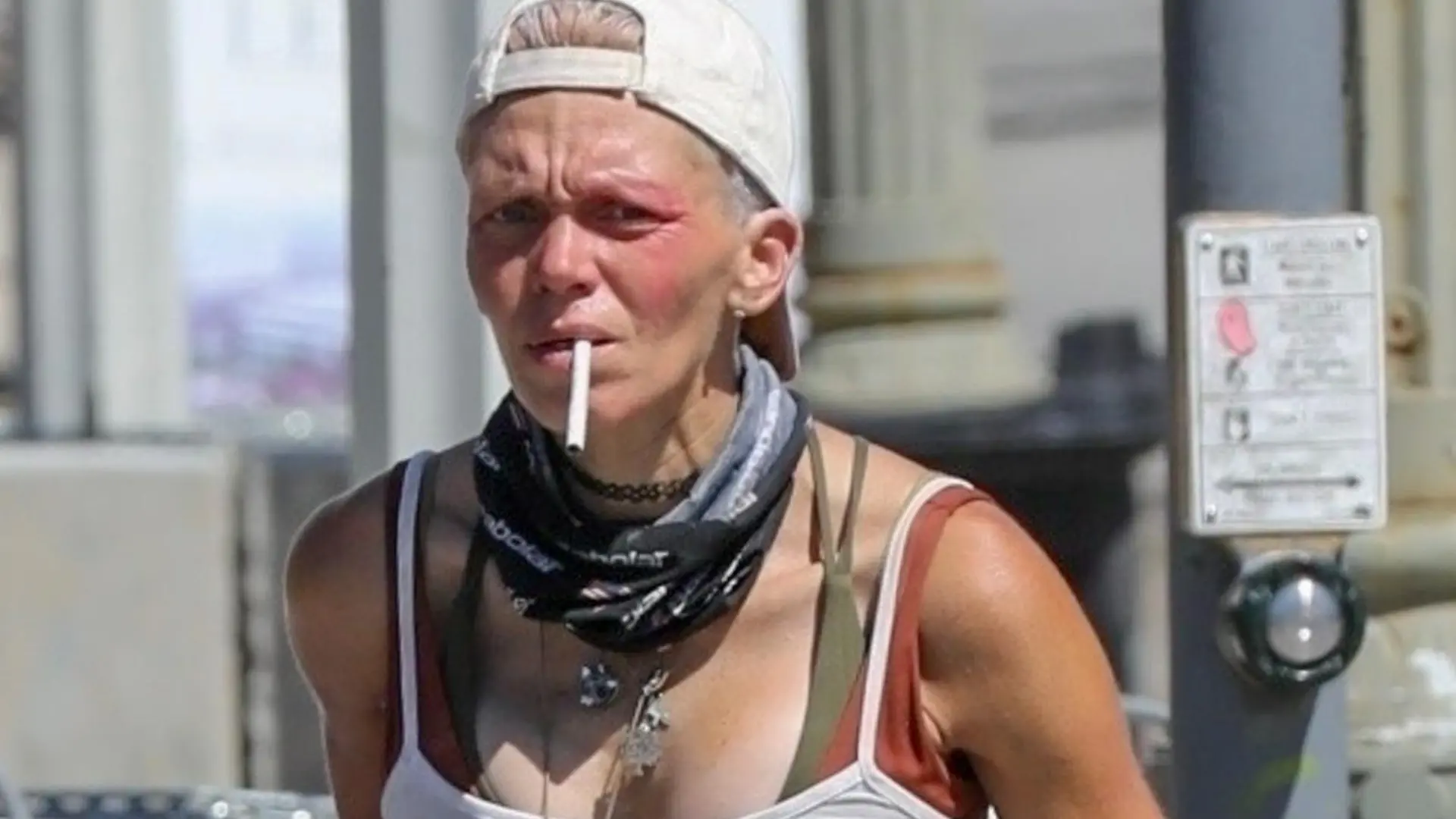 SONDERKONDITIONEN: MINDESTHONORAR: Los Angeles, CA - *EXCLUSIVE* - The struggle is real for former 'Baywatch' star, homeless Loni Willison, as she is seen suffering from a bruised red eye in Los Angeles.
Pictured: Loni Willison
BACKGRID USA 30 AUGUST 2023 


