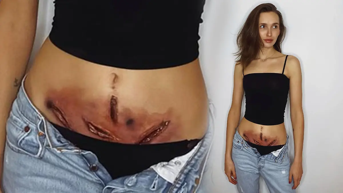 Mit diesem Bild will Anna Wilken das Leben mit Endometriose enttabuisieren