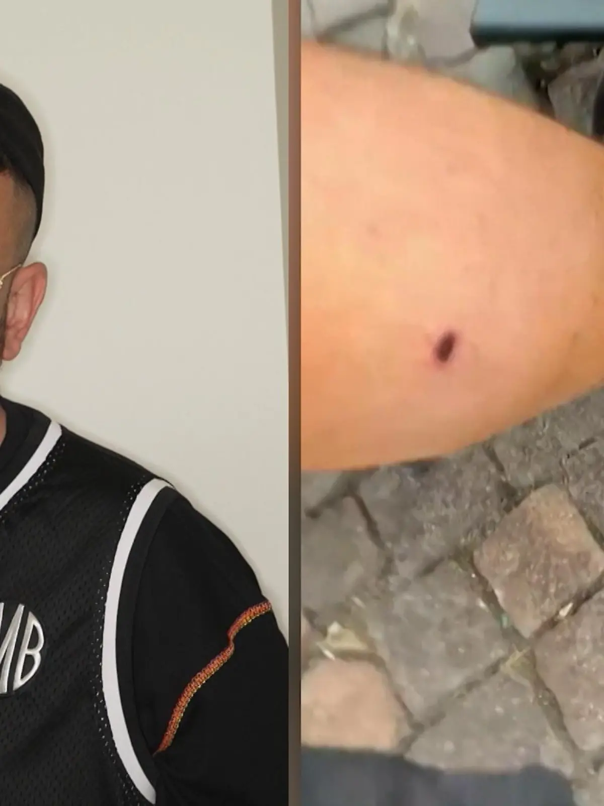 Rapper Haftbefehl hatte 2020 eine Schussverletzung am Bein