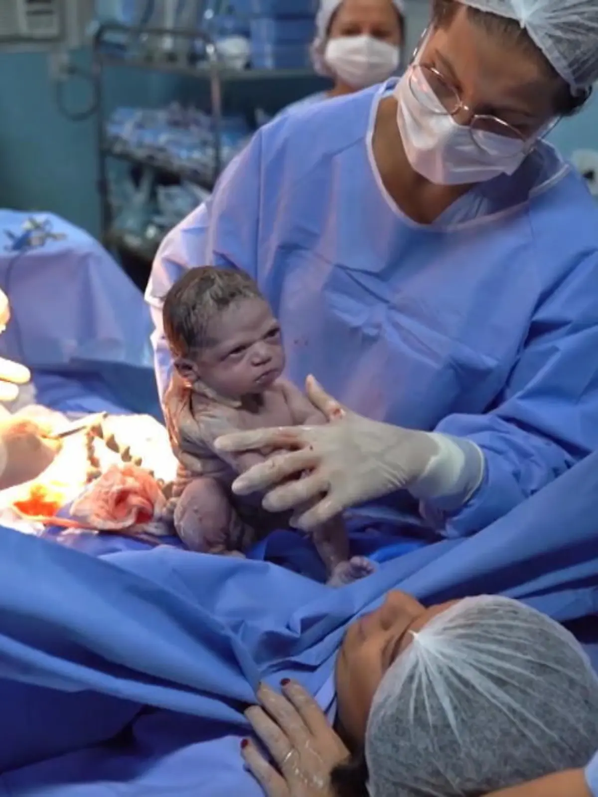 Bild zu: "Baby guckt nach eigener Geburt grimmig"