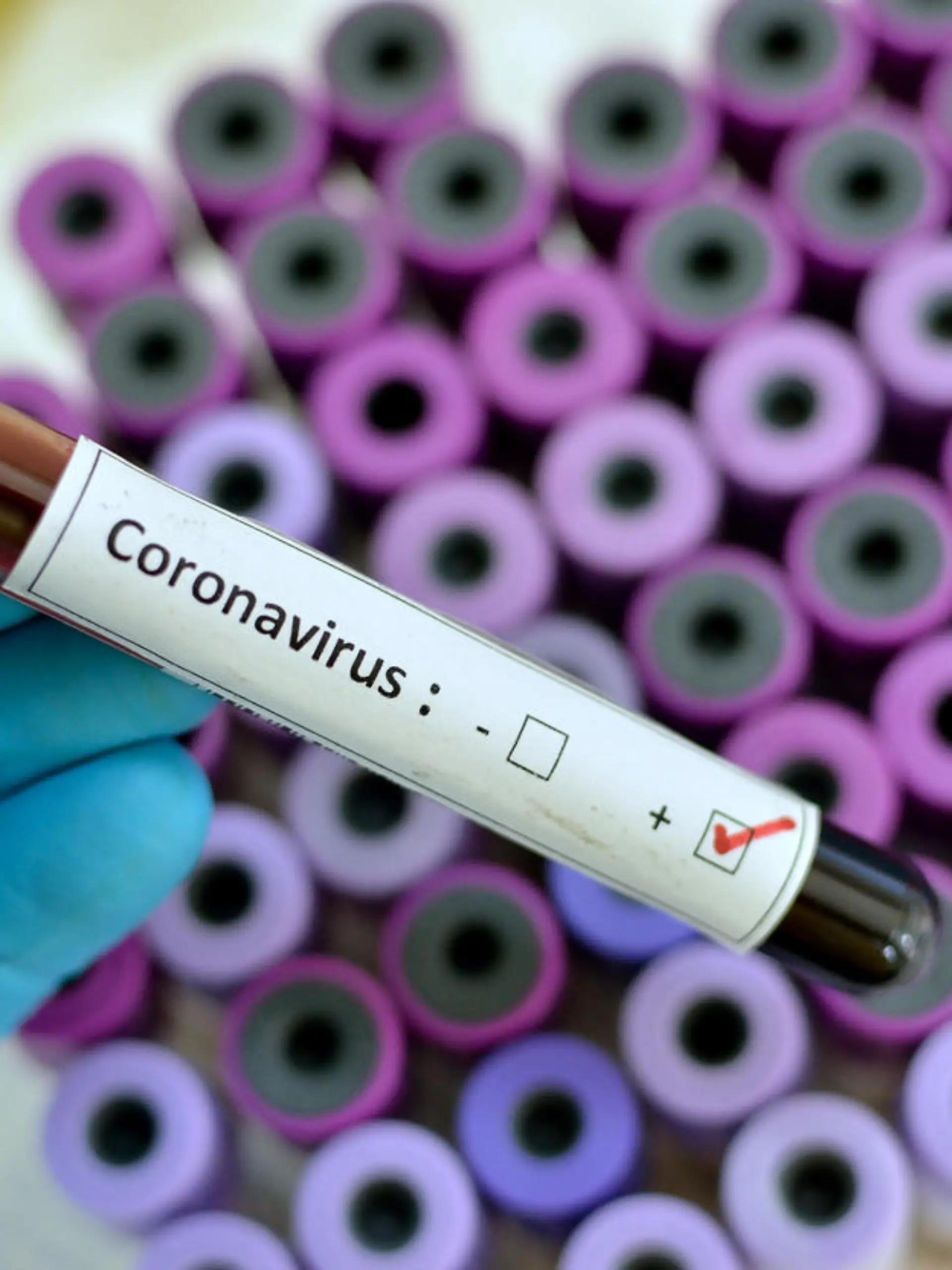 Corona Virus