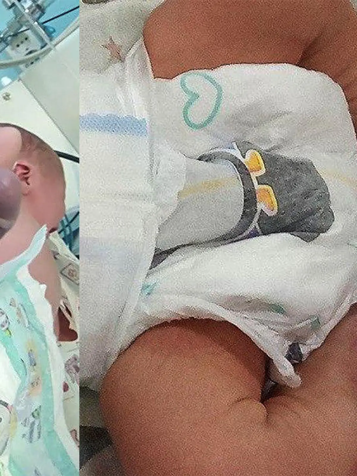 Russland: Baby werden bei Geburt beide Beine durch unqualifizierte Hebamme gebrochen