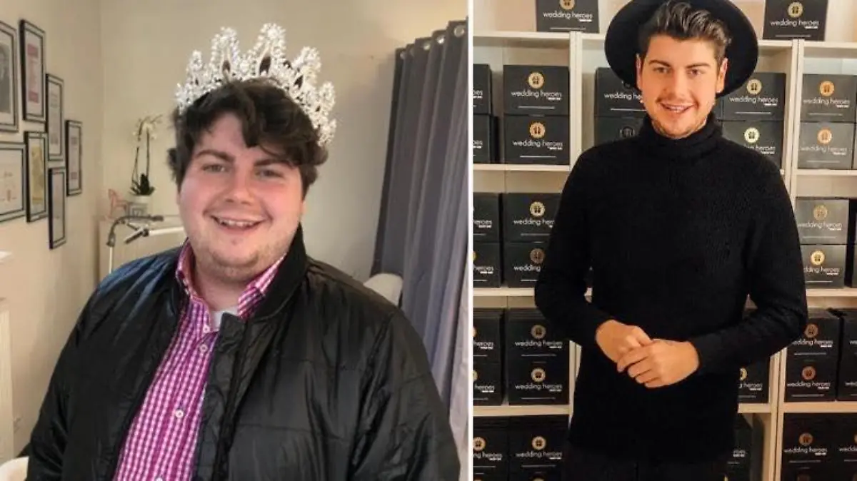 Renè Oliver vor und nach seiner Diät