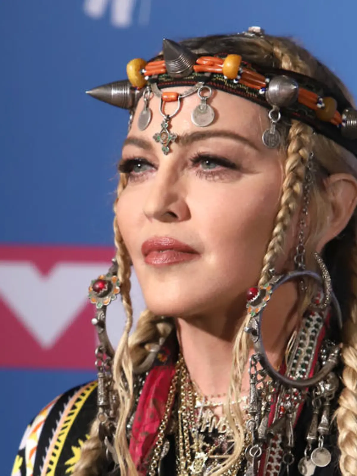 Madonna sagt London-Konzert wegen Verletzungen ab