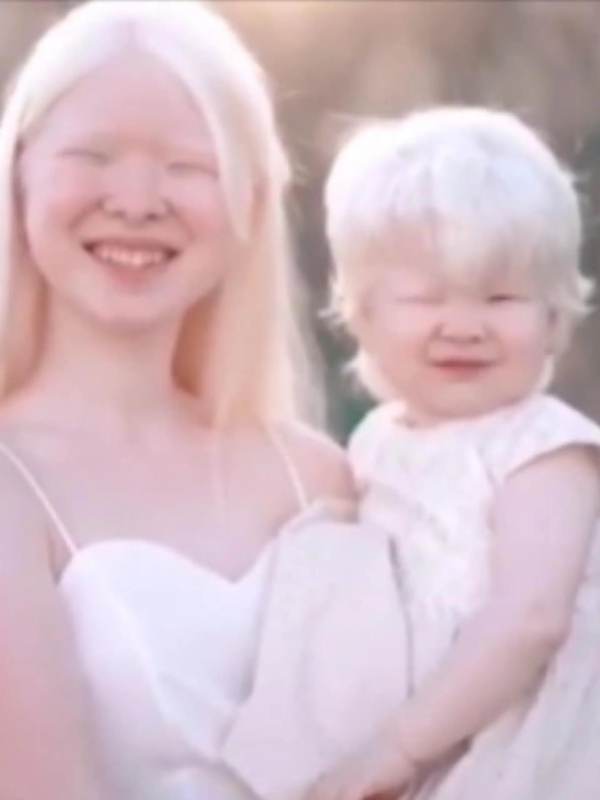 Bild zu: "Schwestern tragen beide das Albino-Gen"
