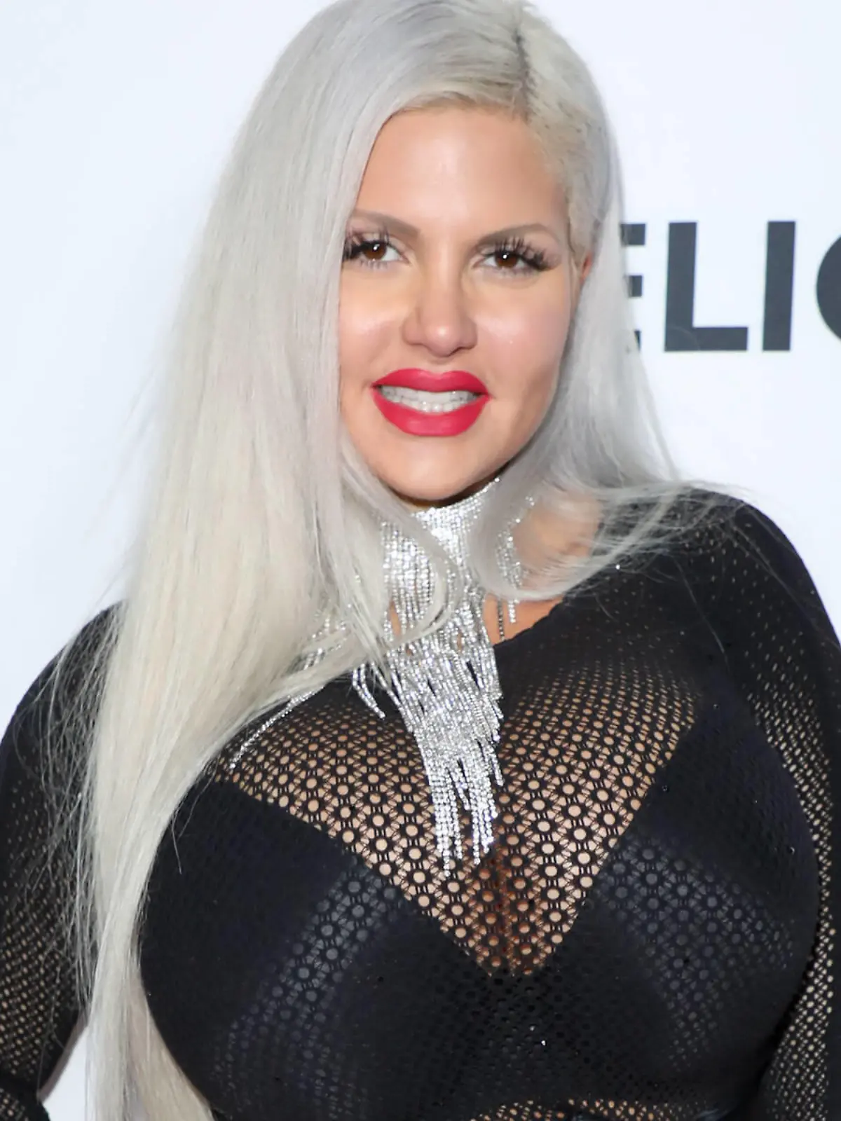 Sophia Vegas: Nach der Geburt zum Beauty-Doc