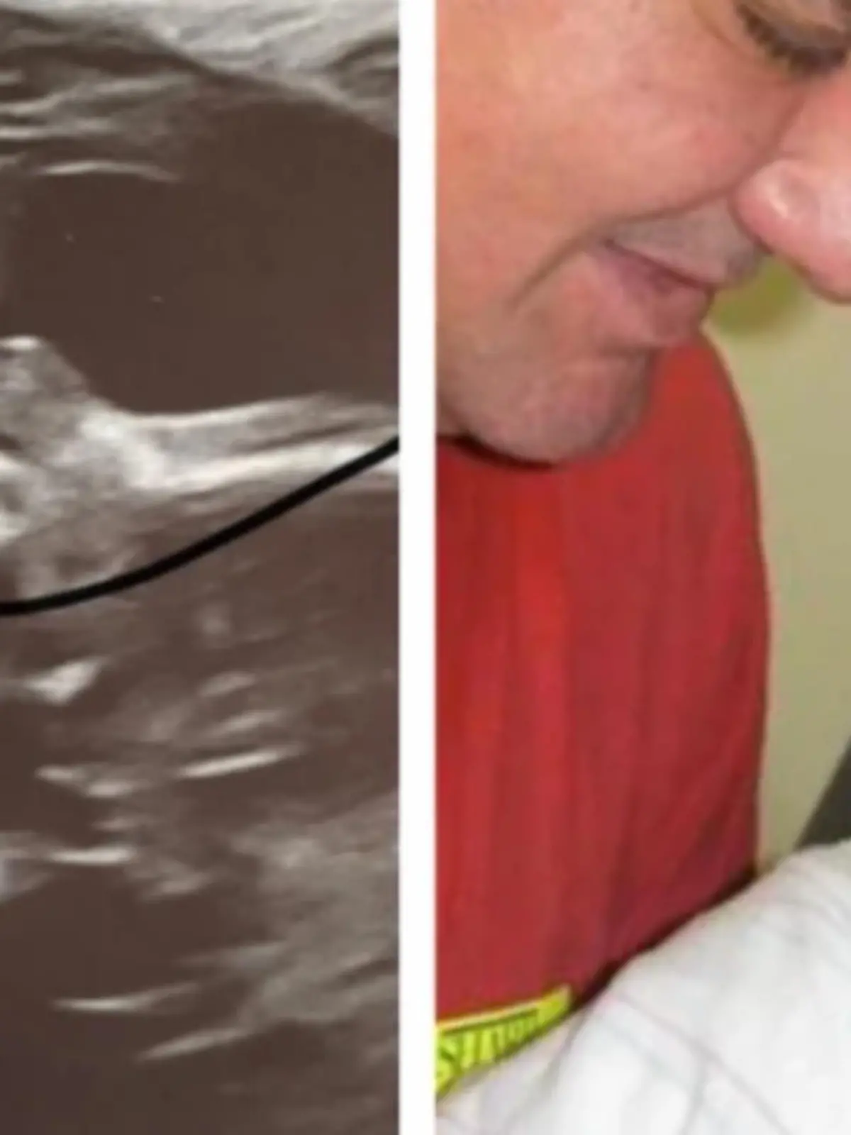 Bild zu: "Frau sieht toten Vater bei Ultraschall"