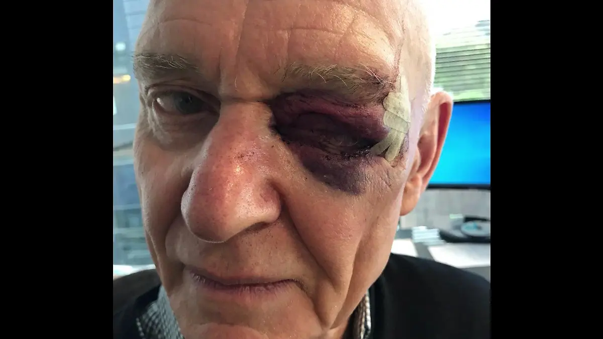 Michael Sauer (76), Opfer eines Raubüberfalls