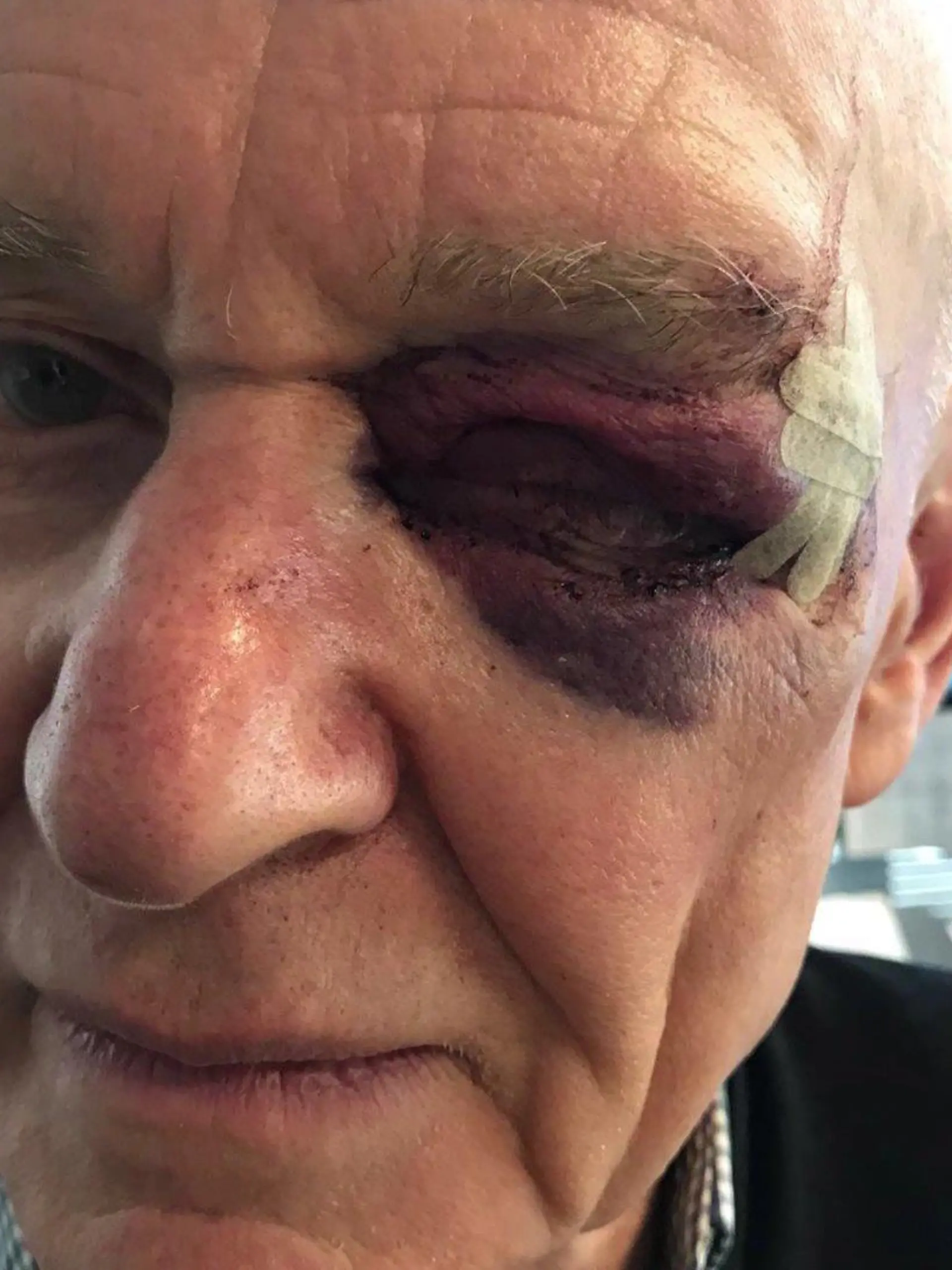 Michael Sauer (76), Opfer eines Raubüberfalls