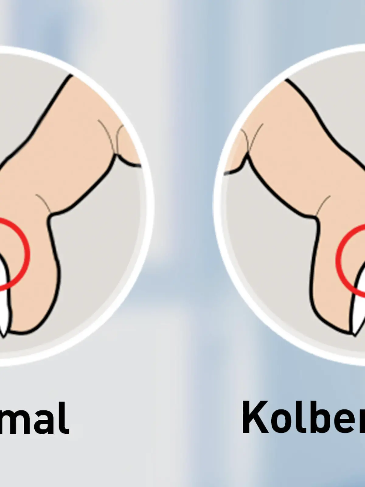 Knubbelfinger