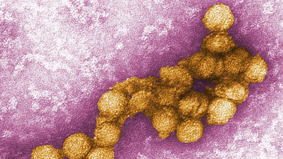 ARCHIV - 22.08.2012, USA, Atlanta: Das West-Nil-Virus unter dem Elektronenmikroskop. Nach einem ersten Fall vor einigen Wochen ist bei zwei weiteren Patienten in Deutschland eine West-Nil-Virus-Infektion nachgewiesen worden. (zu dpa «Zwei weitere bestätigte West-Nil-Virus-Infektionen in Deutschland») Foto: Cynthia Goldsmith/CENTERS FOR DISEASE CONTROL/EPA/dpa - ACHTUNG: Nur zur redaktionellen Verwendung im Zusammenhang mit der aktuellen Berichterstattung und nur mit vollständiger Nennung des vorstehenden Credits +++ dpa-Bildfunk +++