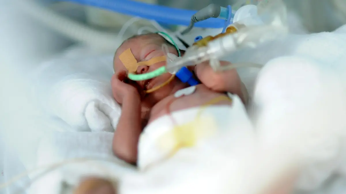 Ein zu  früh geborenes Baby liegt am 05.02.2013 in Berlin in der Neonatologie der Charité in einem Inkubator. Foto: Britta Pedersen