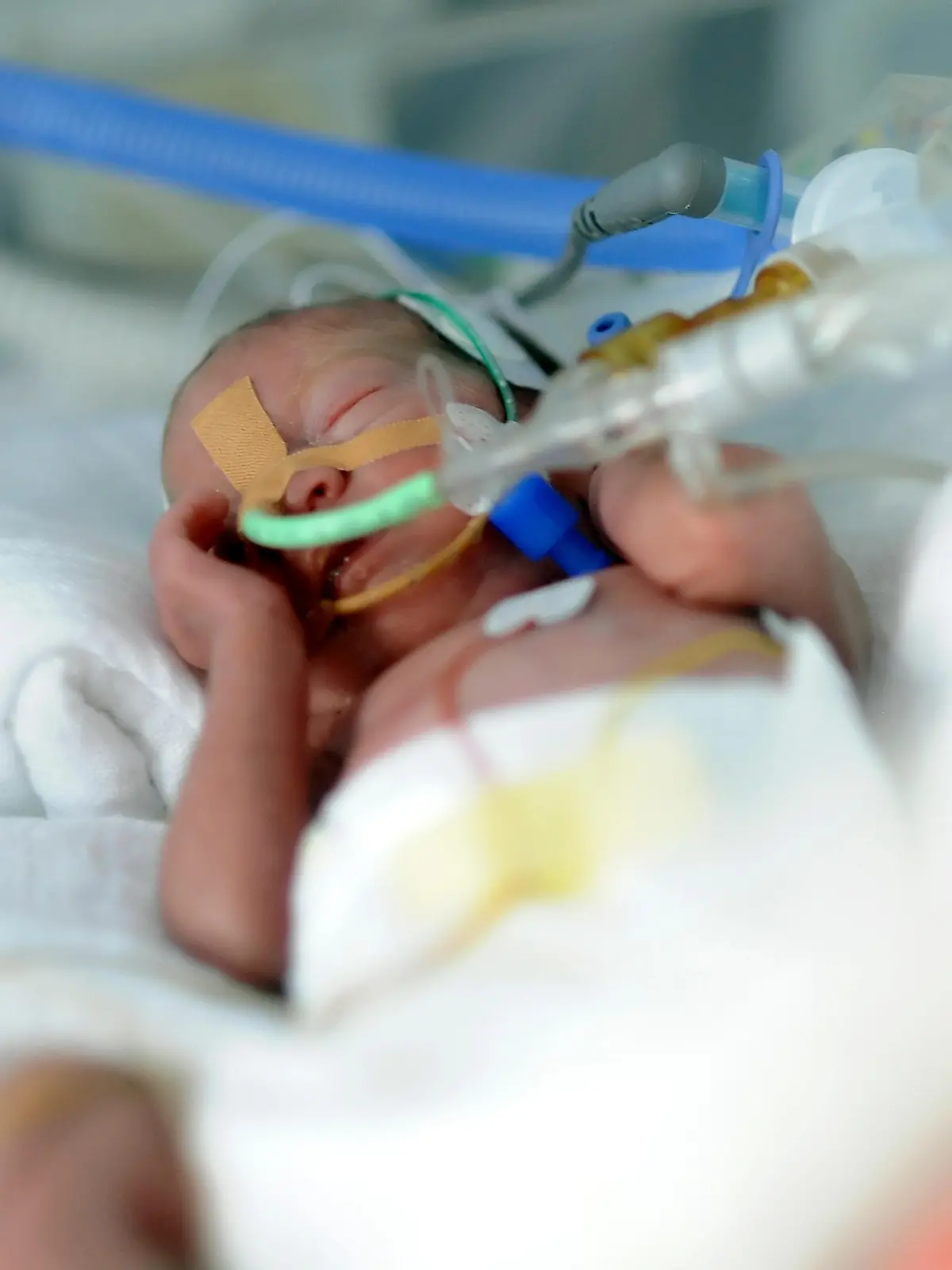 Ein zu  früh geborenes Baby liegt am 05.02.2013 in Berlin in der Neonatologie der Charité in einem Inkubator. Foto: Britta Pedersen