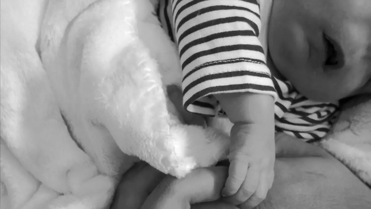 Das Baby aus Portugal wurde ohne Nase und Augen geboren.
