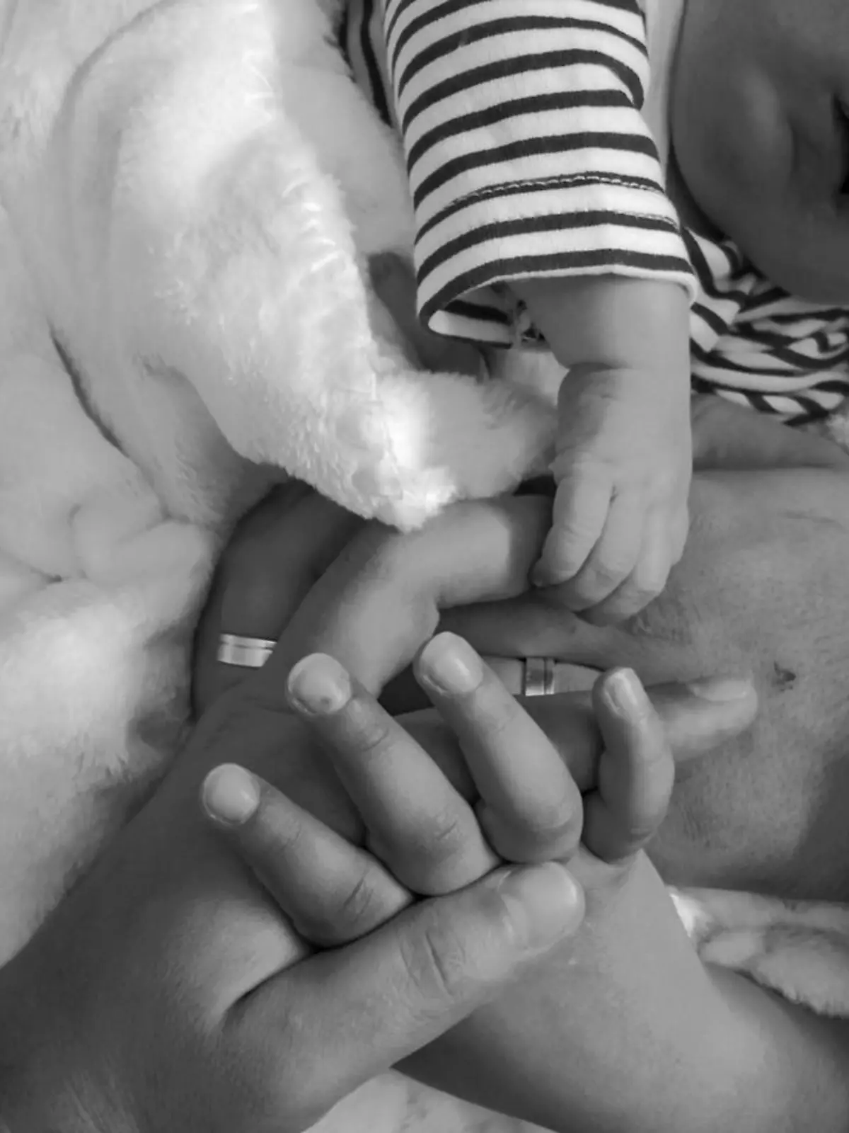 Das Baby aus Portugal wurde ohne Nase und Augen geboren.