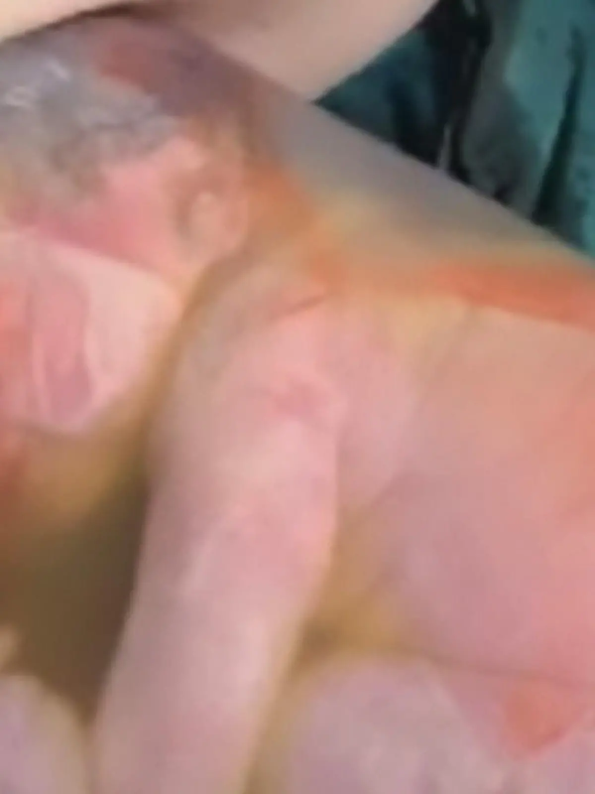 Baby mit Glückshaube in China geboren: Die Fruchtblase ist dabei völlig intakt.
