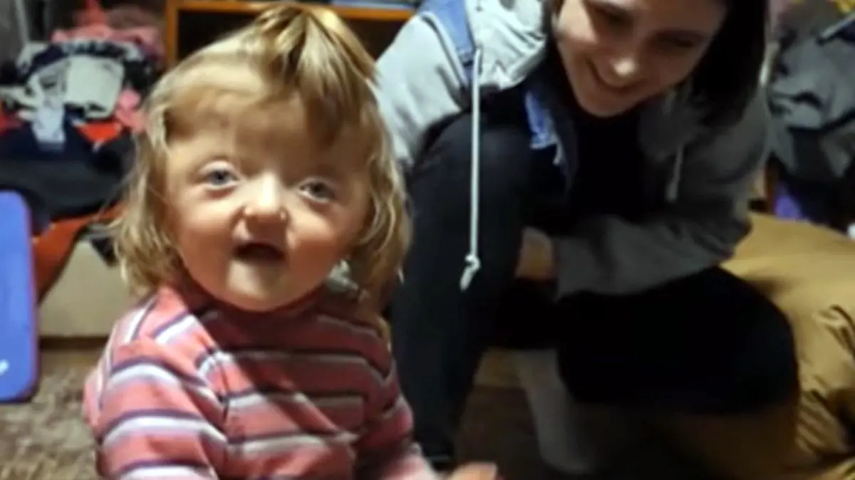 Die zweijährige Sofya Zakharova darf nicht in den Kindergarten, weil sie anders aussieht.