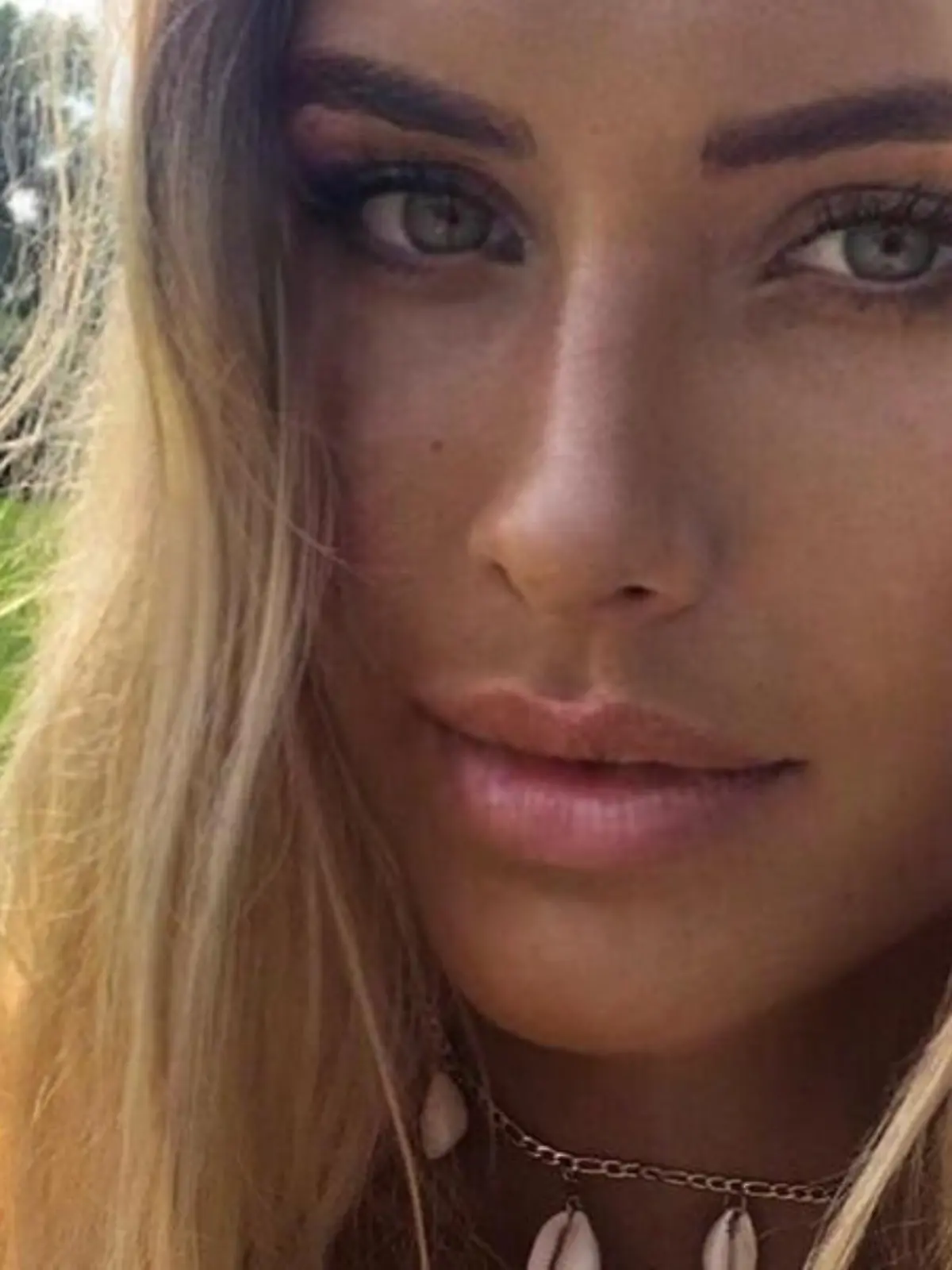 Bild zu: "Alena Gerber zeigt Mager-Schock-Foto"