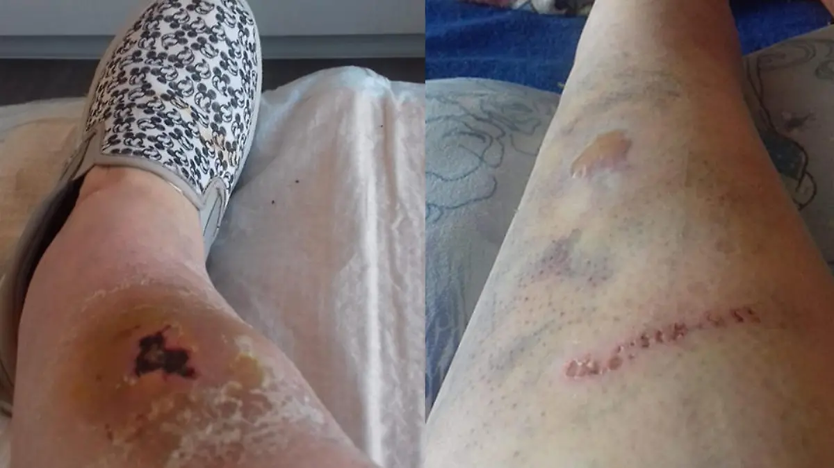 Stups erleidet durch ihren Sturz heftige Verletzungen - aber es geht ihr den Umständen entsprechend gut.