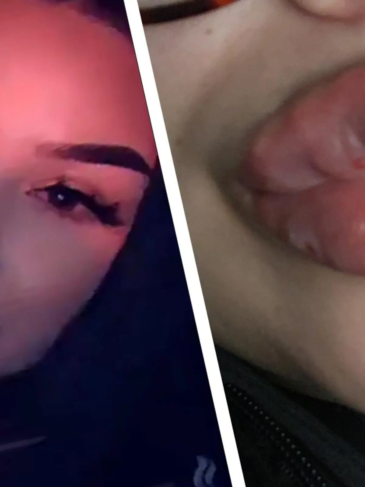 Ashleigh Villaverde: Entzündete Schlauchboot-Lippen statt Kussmund