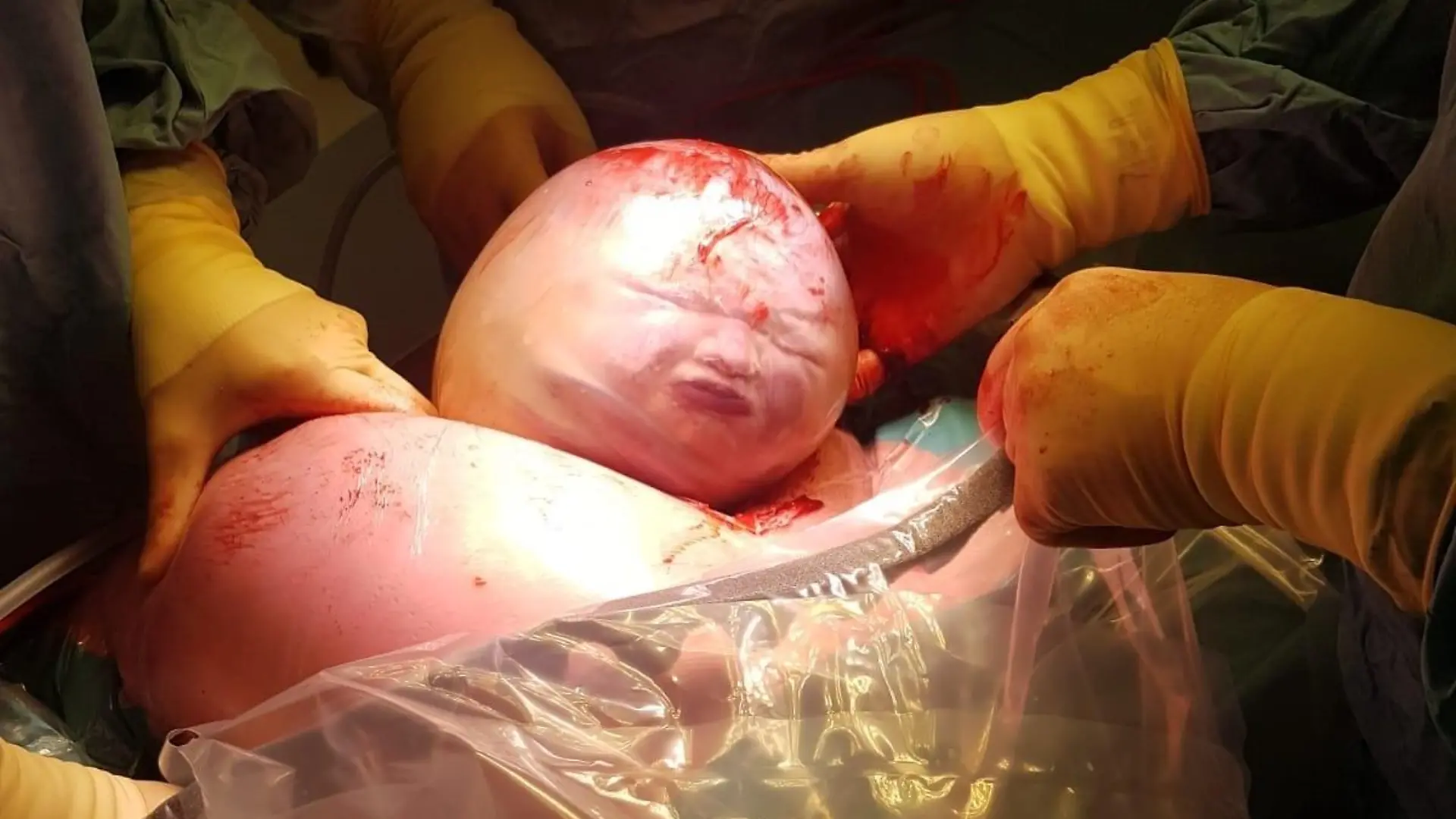 Baby in Fruchtblase