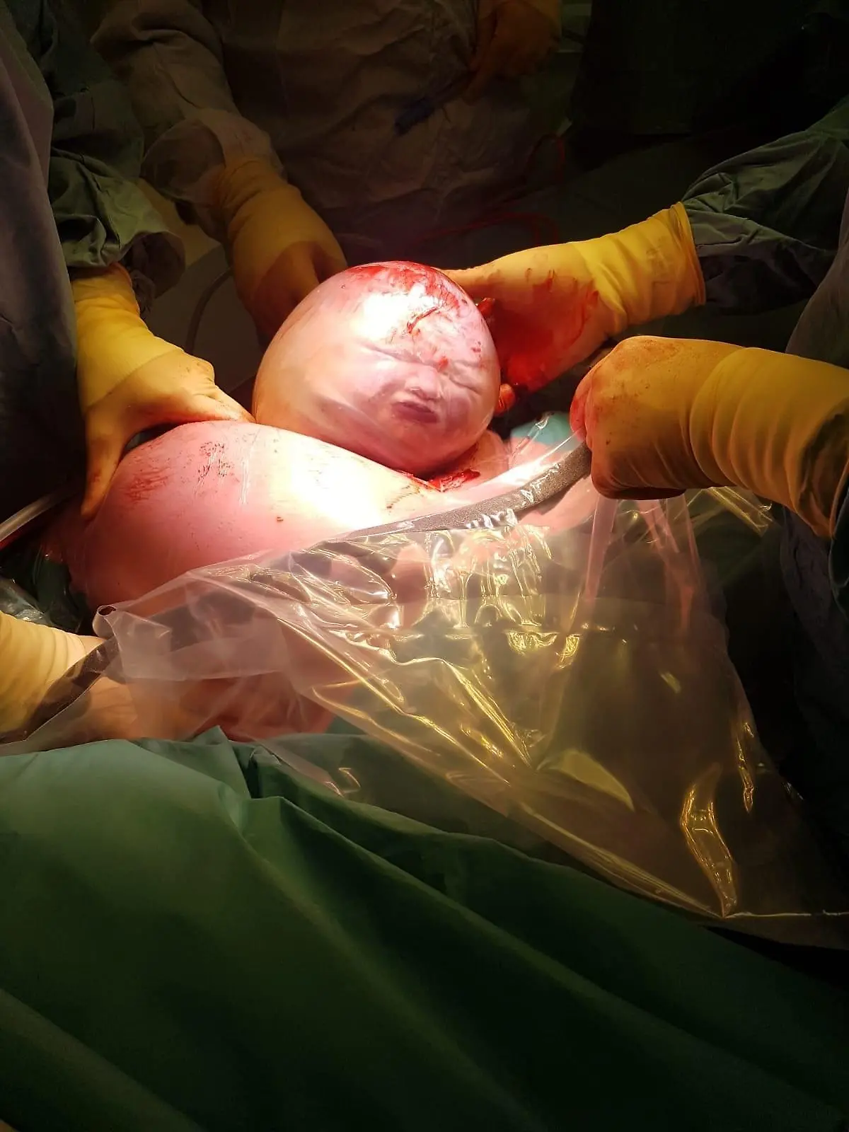 Baby in Fruchtblase