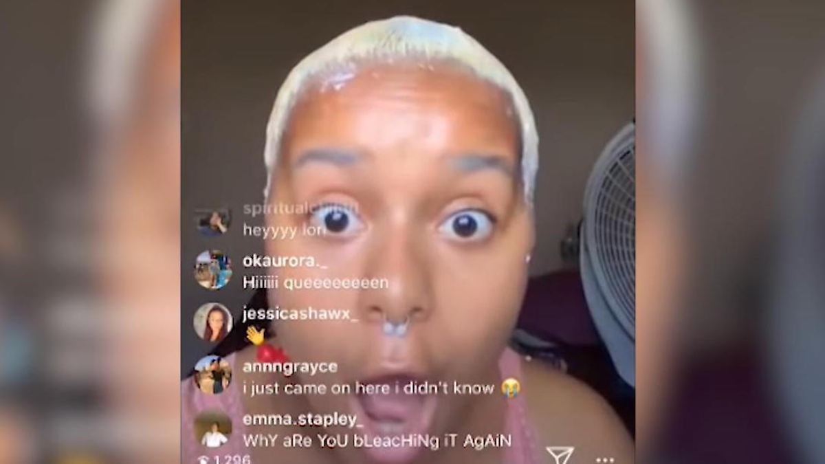 Instagramerin fallen im Livestream die Haare aus