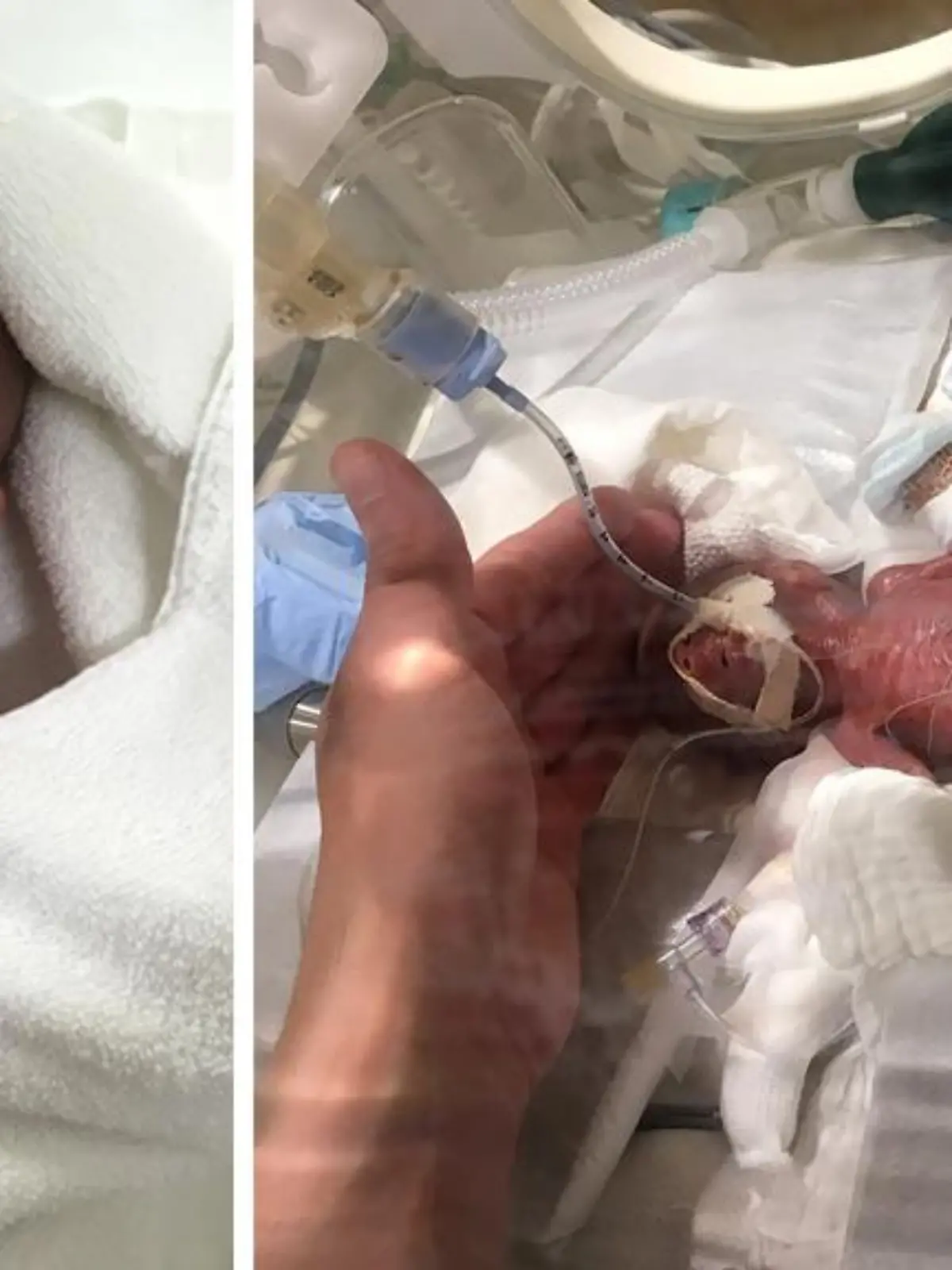 Nach fünf Monaten in der Klinik ist der nun so schwer wie andere Babys bei ihrer Geburt.
