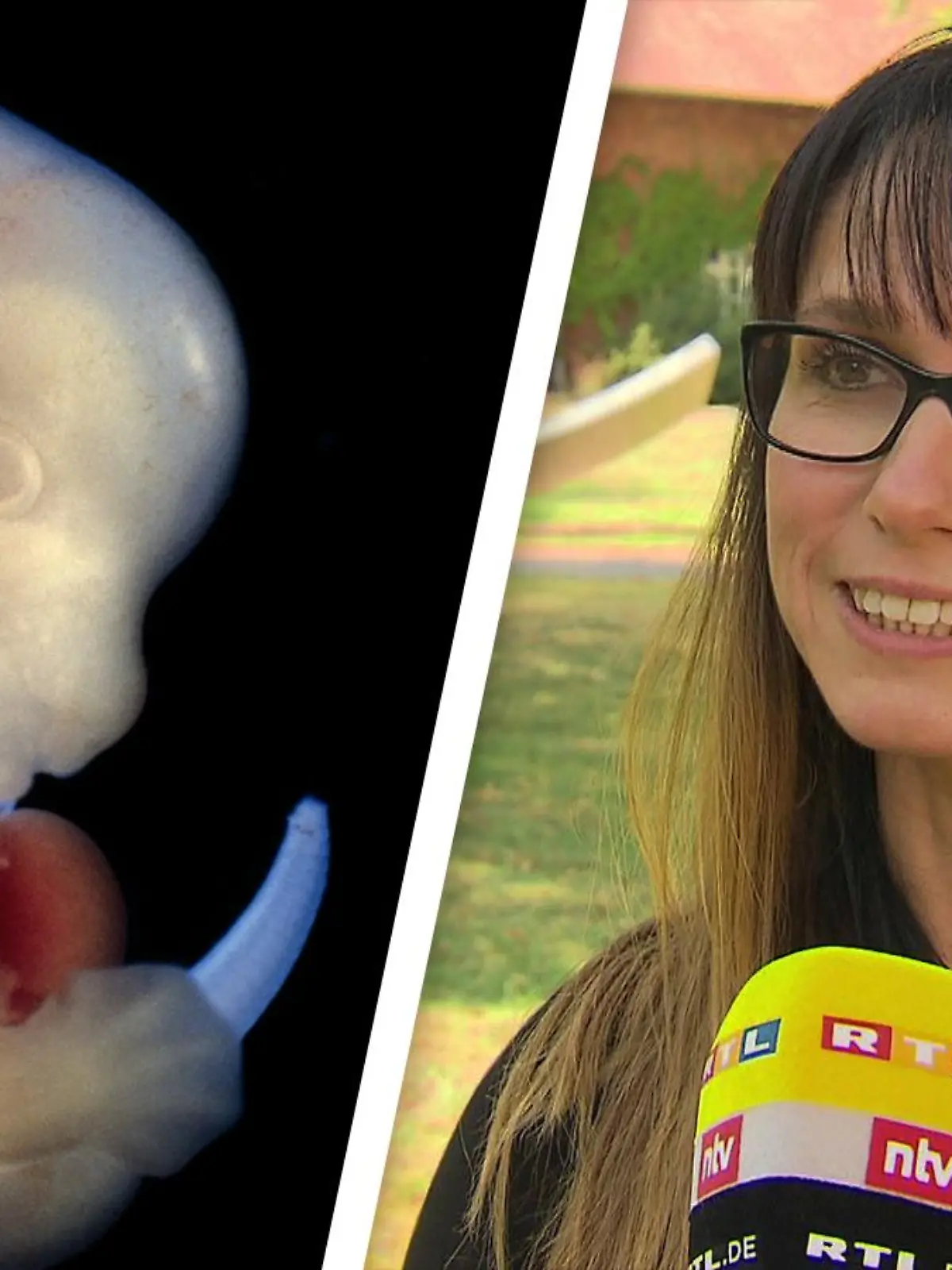 Links: Ein Rattenembryo in Lichtmikroskop-Aufnahme. Rechts: Monika Nowak-Imialek vom Institut für Tiergenetik.