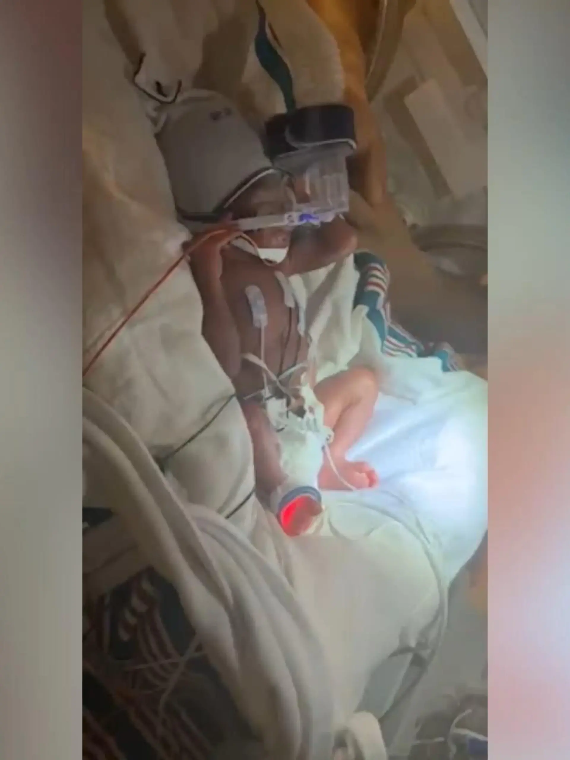Drei Monate ist der kleine Kayden zu früh auf die Welt gekommen - die Ärzte waren sich eigentlich sicher, dass er deshalb nicht überleben wird. Aber wen sehen wir in diesem Video, vier Monate später, wohlauf? Richtig - Kayden, der sich entgegen aller Erwartungen durchgekämpft hat.