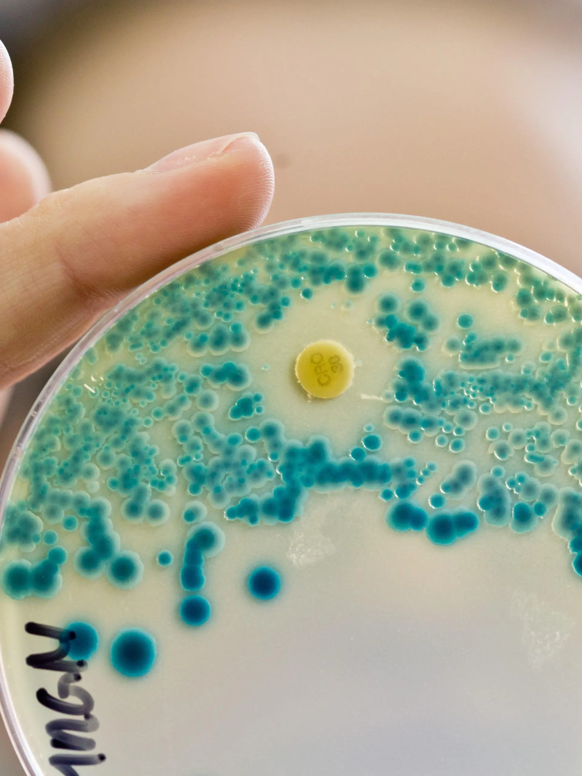 ARCHIV - Eine Labormitarbeiterin am Institut für Klinische Mikrobiologie, Immunologie und Hygiene des Universitätsklinikums in Erlangen (Bayern), hält am 21.07.2015 im Diagnostiklabor eine Indikatorkulturplatte zum Nachweis von resistenten Bakterien in der Hand. Foto: Daniel Karmann/dpa (zu dpa: "Weniger Antibiotika: Gröhe will zielgenauen Einsatz fördern" vom 07.08.2016) +++(c) dpa - Bildfunk+++