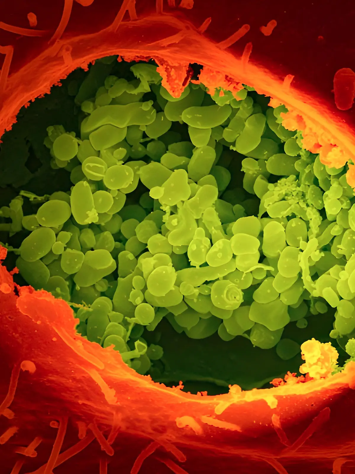 This image shows the Q fever (yellow) bacterium, which infects cows, sheep and goats worldwide and can also infect humans. When detected early, Q fever can be cured with risks. A small fraction of the population may develop a more severe chronic form of the disease.