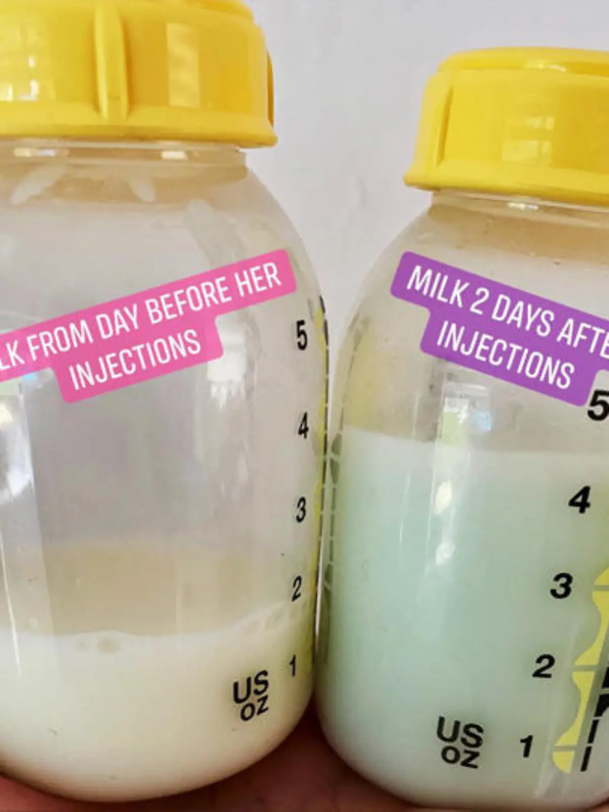 Jody Fisher aus Birmingham zeigt blaue Muttermilch nach Impfung ihres Babys