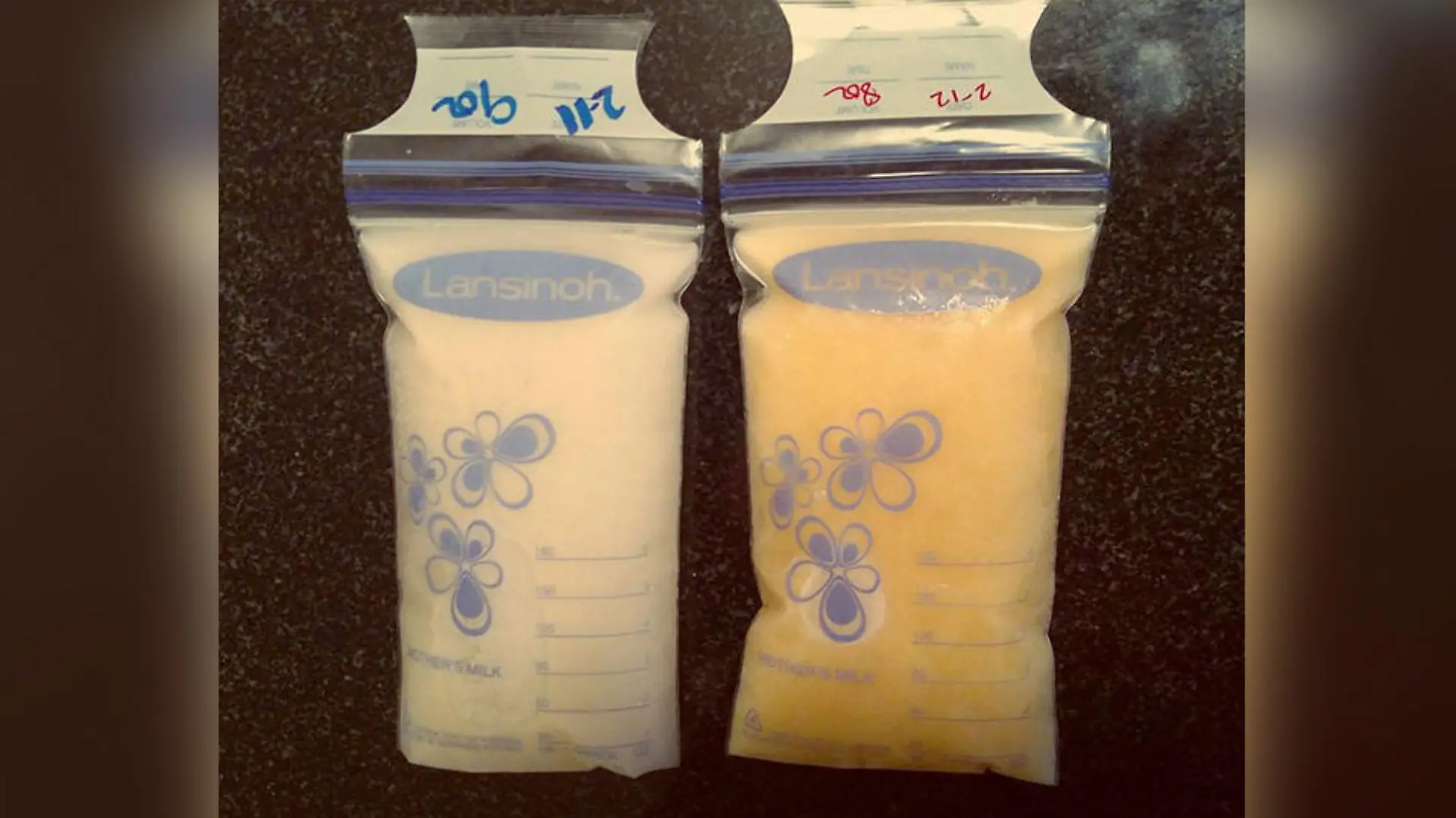 Mallory Smothers' verfärbte Muttermilch