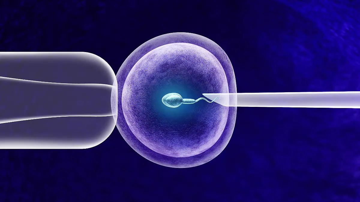 In-vitro-Fertilisation