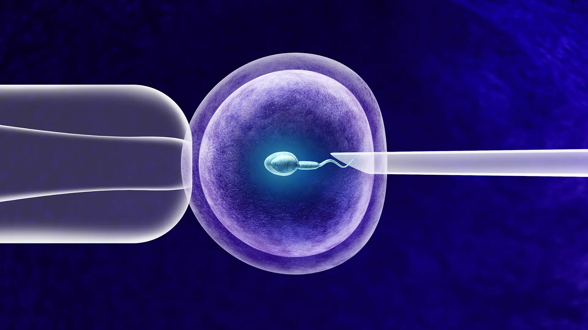 In-vitro-Fertilisation