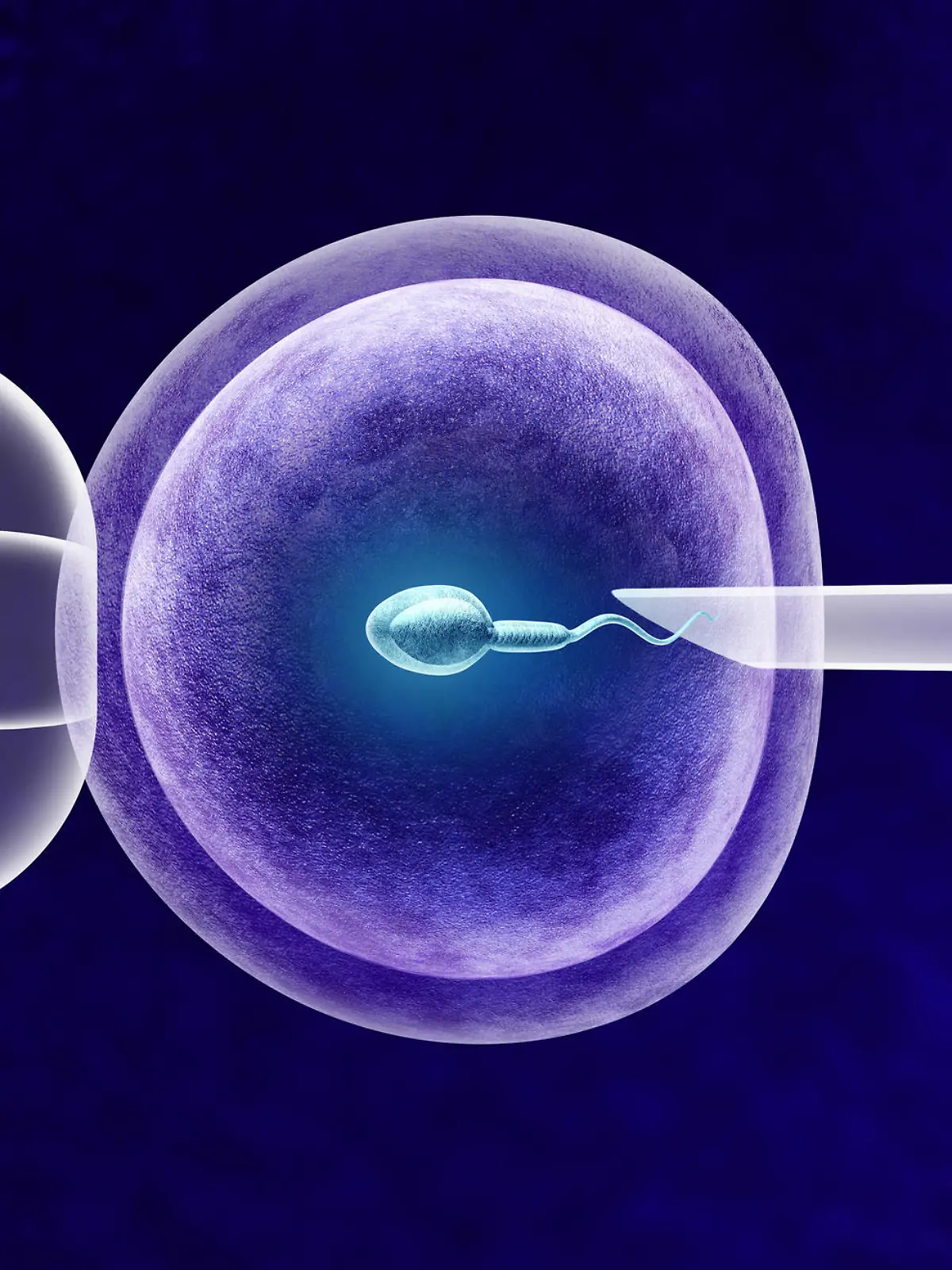 In-vitro-Fertilisation