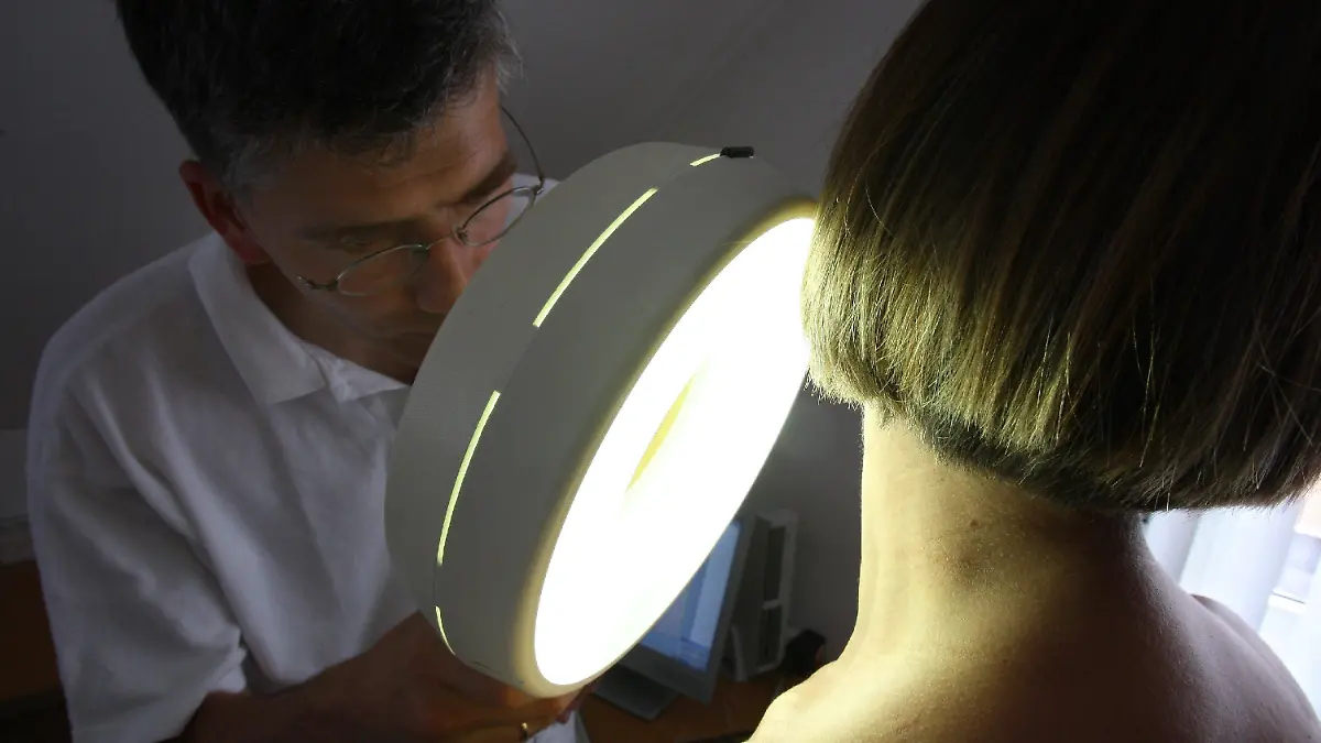 Ein Hautarzt untersucht in seiner Praxis in Buchloe (Schwaben) mit einemVergrößerungsglas die Haut einer Patientin bei einer Hautkrebs-Früherkennung (Illustration zum Thema "Hautkrebs-Vorsorge", aufgenommen am 25.06.2008). Gesetzlich Versicherte können ab 1. Juli ihre Haut auf Kassenkosten auf Krebs untersuchen lassen. Nach der grundsätzlichen Entscheidung hätten sich Krankenkassen und Kassenärztliche Bundesvereinigung (KBV) nun auch beim Ärztehonorar für die Hautkrebsfrüherkennung geeinigt, teilte die KBV am Donnerstag (26.06.2008) in Berlin mit. Foto: Karl-Josef Hildenbrand dpa/lby (zu dpa 4155) +++(c) dpa - Bildfunk+++