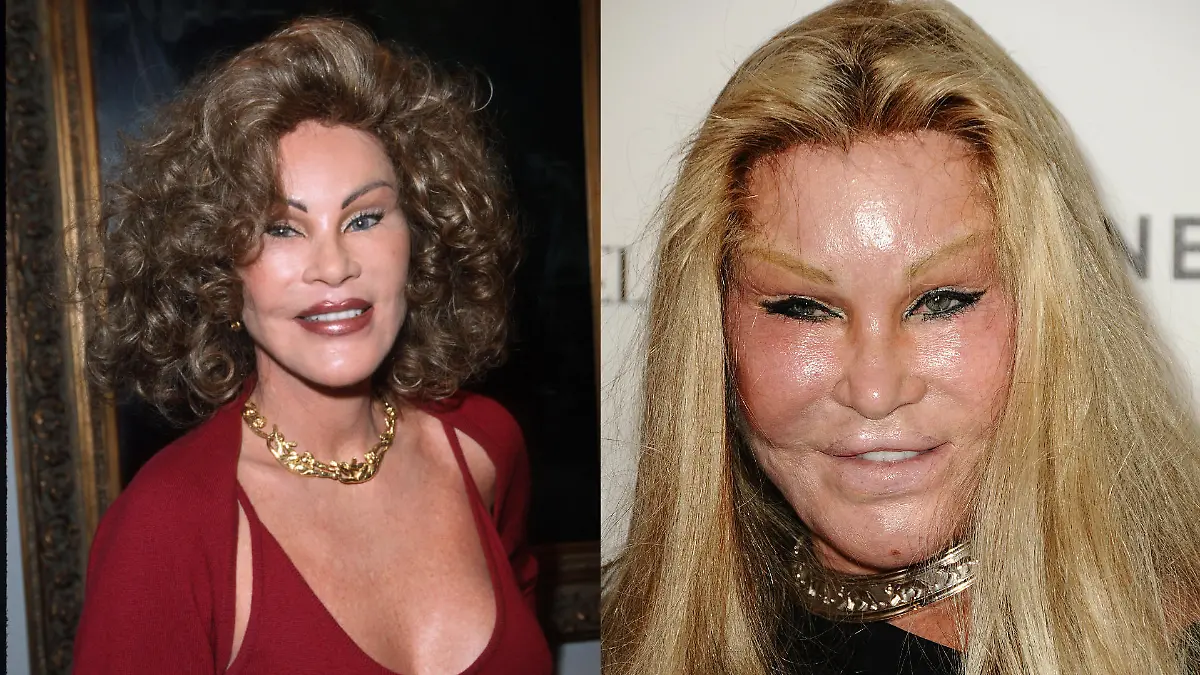 Jocelyn Wildenstein im Wandel der Zeit