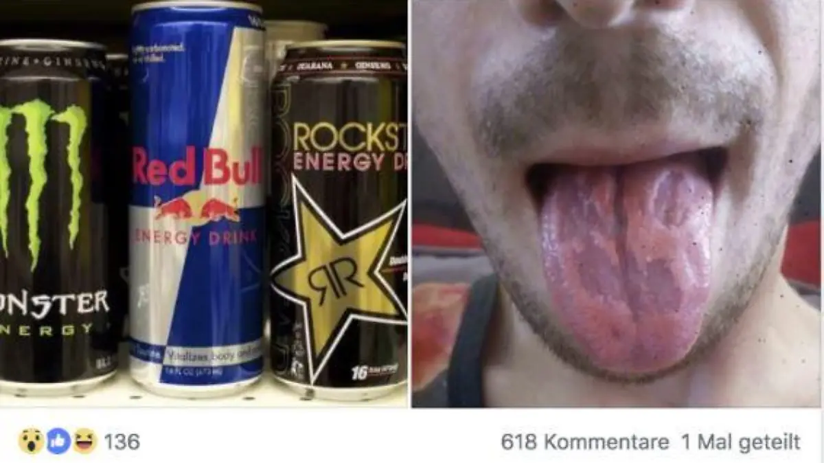 Energy Drinks und fiese Zunge
